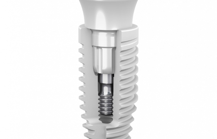 Neodent® Zi Ceramic Implant System